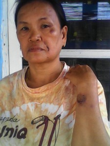 SADISNYA PENGANIAYAAN YANG DI DUGA DILAKUKAN OLEH : REZA CS SILA