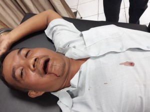 OKNUM PERANGKAT DESA PEMABUK ANIAYA PEMILIK PANTI