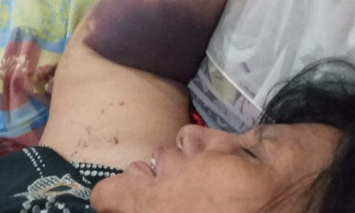 RS Isllam Fatumah Banyuwangi Diduga Malpraktik Pasien Terpapar Covid-19