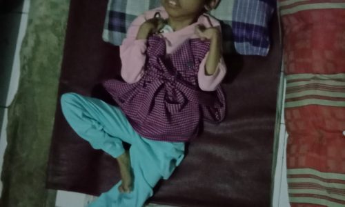 Anak Usia 8 Tahun Derita Kurang Gizi Berat Cuma 6kg