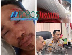 TOPAN RI Desak Polsek Kisaran Kota Tuntaskan Kasus Penganiayaan Berat di Asahan
