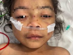 Kejam! Ibu Tiri Aniaya Bocah Balita 4 Tahun di Bekasi Hingga Meregang Nyawa