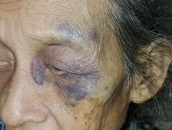 Nenek Renta di Tojo Una-Una Diduga Dianiaya, Keluarga Minta Pelaku Diproses Hukum